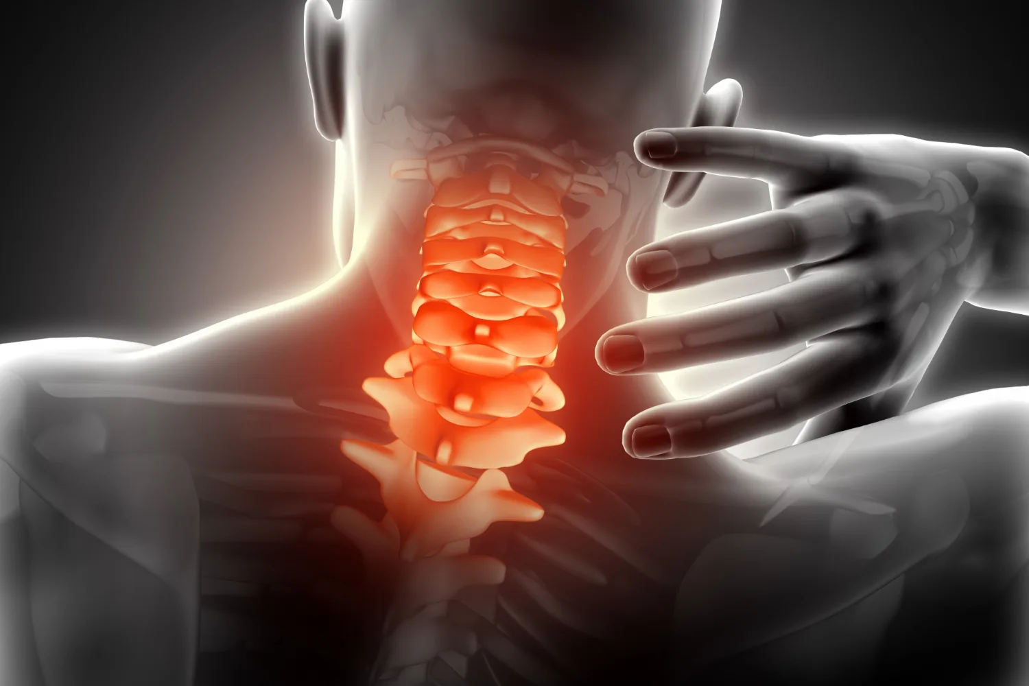 Estenosis del canal vertebral en CDMX: atención especializada en neurocirugía